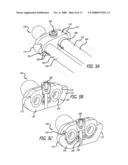 ADJUSTABLE ABSORBER DESIGNS FOR IMPLANTABLE DEVICE diagram and image