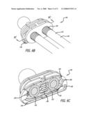 ADJUSTABLE ABSORBER DESIGNS FOR IMPLANTABLE DEVICE diagram and image