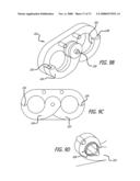 ADJUSTABLE ABSORBER DESIGNS FOR IMPLANTABLE DEVICE diagram and image