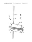 ADJUSTABLE ABSORBER DESIGNS FOR IMPLANTABLE DEVICE diagram and image