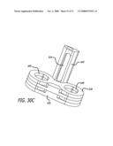 ADJUSTABLE ABSORBER DESIGNS FOR IMPLANTABLE DEVICE diagram and image