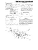 ADJUSTABLE ABSORBER DESIGNS FOR IMPLANTABLE DEVICE diagram and image