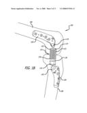 ADJUSTABLE ABSORBER DESIGNS FOR IMPLANTABLE DEVICE diagram and image