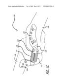 ADJUSTABLE ABSORBER DESIGNS FOR IMPLANTABLE DEVICE diagram and image