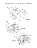 ADJUSTABLE ABSORBER DESIGNS FOR IMPLANTABLE DEVICE diagram and image