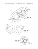 ADJUSTABLE ABSORBER DESIGNS FOR IMPLANTABLE DEVICE diagram and image