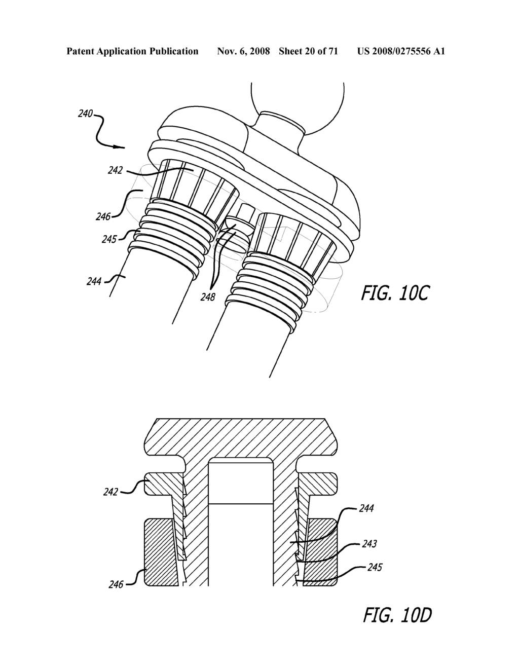 ADJUSTABLE ABSORBER DESIGNS FOR IMPLANTABLE DEVICE - diagram, schematic, and image 21