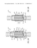 ADJUSTABLE ABSORBER DESIGNS FOR IMPLANTABLE DEVICE diagram and image