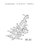 ADJUSTABLE ABSORBER DESIGNS FOR IMPLANTABLE DEVICE diagram and image