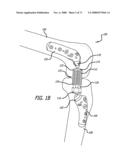 ADJUSTABLE ABSORBER DESIGNS FOR IMPLANTABLE DEVICE diagram and image