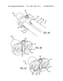 ADJUSTABLE ABSORBER DESIGNS FOR IMPLANTABLE DEVICE diagram and image