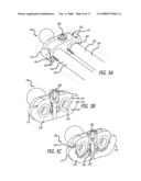 ADJUSTABLE ABSORBER DESIGNS FOR IMPLANTABLE DEVICE diagram and image