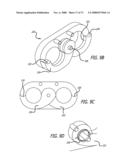 ADJUSTABLE ABSORBER DESIGNS FOR IMPLANTABLE DEVICE diagram and image