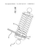 ADJUSTABLE ABSORBER DESIGNS FOR IMPLANTABLE DEVICE diagram and image