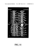 Methods and Compositions Related to Delivery of Chemical Compounds to Invertebrate Embryos diagram and image