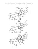 Appendage Elevation System, Adjustment Mechanism and Method of Use diagram and image