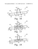 Appendage Elevation System, Adjustment Mechanism and Method of Use diagram and image