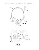 APPARATUS FOR DELIVERING AND/OR SCAVENGING GAS IN THE NOSE/MOUTH AREA OF A PATIENT diagram and image