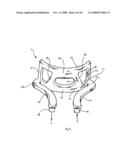 Moulds for Moulding Objects Made of Plastics and a Method for Producing a Mould Element diagram and image