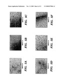 METHODS OF TREATMENT AND PREVENTION OF NEURODEGENERATIVE DISEASES AND DISORDERS diagram and image