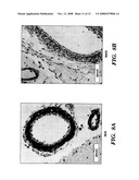 METHODS OF TREATMENT AND PREVENTION OF NEURODEGENERATIVE DISEASES AND DISORDERS diagram and image