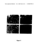 ALK protein tyrosine kinase, cells and methods embodying and using same diagram and image