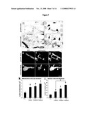 Use of Microtubule Stabilizing Compounds for the Treatment of Lesions of Cns Axons diagram and image