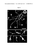 Use of Microtubule Stabilizing Compounds for the Treatment of Lesions of Cns Axons diagram and image