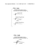 Treatment Of Injury To The Brain By Inhibition Of Acid Sensing ION Channels diagram and image