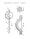 Methods for asymmetrical irradiation of a body cavity diagram and image