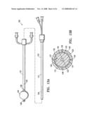 Methods for asymmetrical irradiation of a body cavity diagram and image