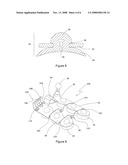 Suction Cup Epicardial Stabilizer Device for Cardiac Surgery diagram and image