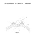 Suction Cup Epicardial Stabilizer Device for Cardiac Surgery diagram and image