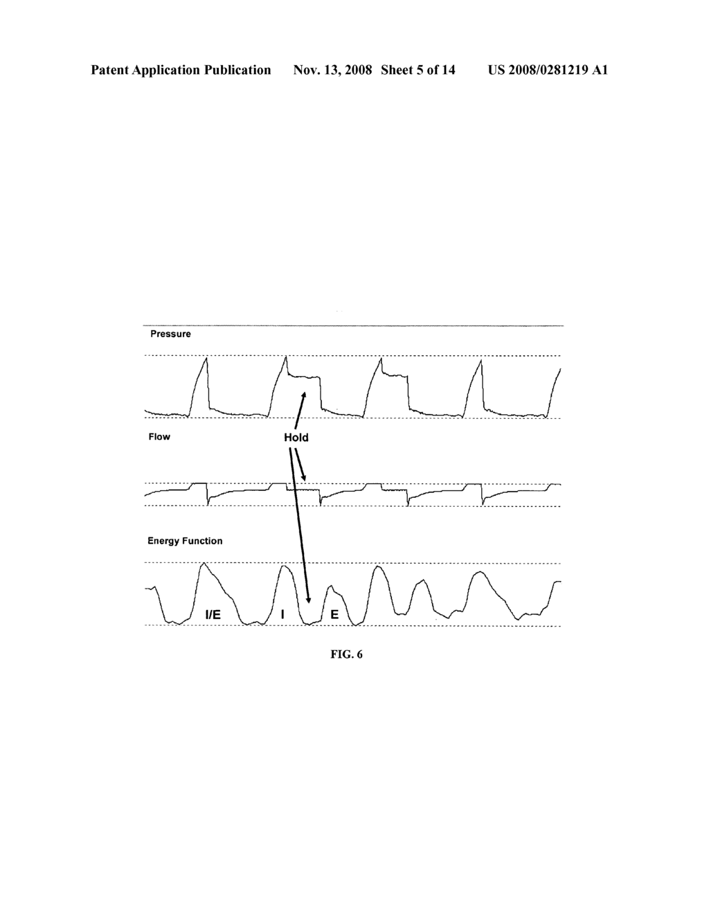 Method and System for Assessing Lung Condition and Managing Mechanical Respiratory Ventilation - diagram, schematic, and image 06