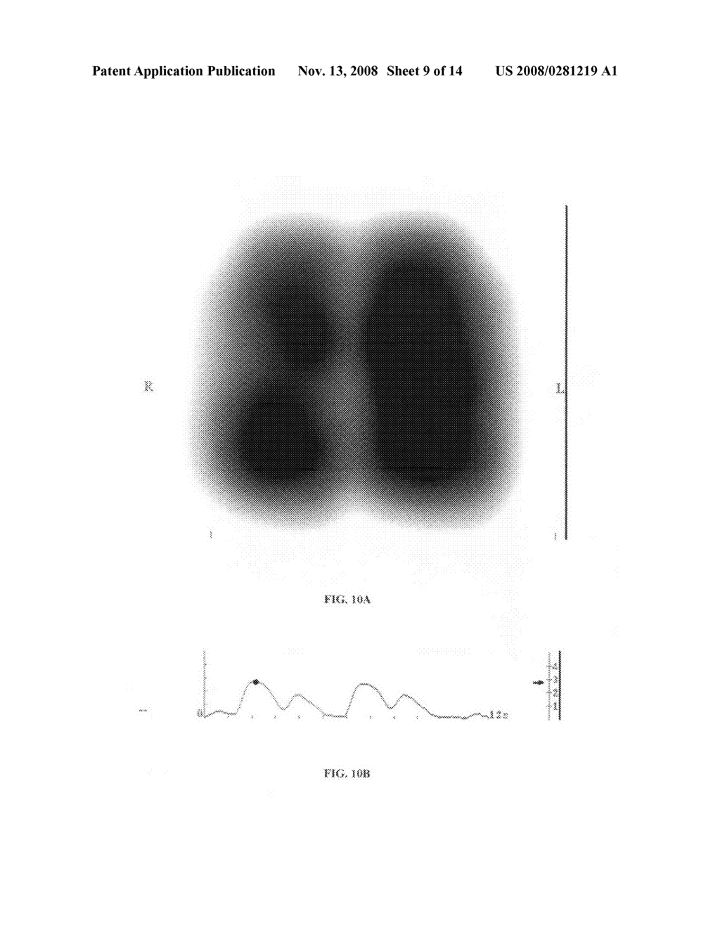 Method and System for Assessing Lung Condition and Managing Mechanical Respiratory Ventilation - diagram, schematic, and image 10