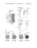 VISCERAL PLEURA RING CONNECTOR diagram and image