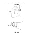 VISCERAL PLEURA RING CONNECTOR diagram and image