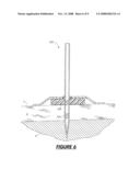 EXTERNAL FIXATION ASSEMBLY AND METHOD OF USE diagram and image