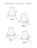 Patient Selectable Joint Arthroplasty Devices and Surgical Tools diagram and image