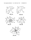 Patient Selectable Joint Arthroplasty Devices and Surgical Tools diagram and image