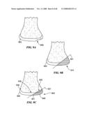 Patient Selectable Joint Arthroplasty Devices and Surgical Tools diagram and image