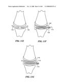 Patient Selectable Joint Arthroplasty Devices and Surgical Tools diagram and image