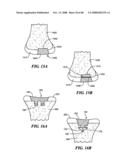 Patient Selectable Joint Arthroplasty Devices and Surgical Tools diagram and image