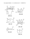 Patient Selectable Joint Arthroplasty Devices and Surgical Tools diagram and image