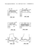 Patient Selectable Joint Arthroplasty Devices and Surgical Tools diagram and image