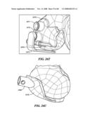 Patient Selectable Joint Arthroplasty Devices and Surgical Tools diagram and image