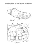 Patient Selectable Joint Arthroplasty Devices and Surgical Tools diagram and image