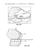 Patient Selectable Joint Arthroplasty Devices and Surgical Tools diagram and image