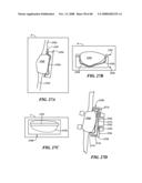 Patient Selectable Joint Arthroplasty Devices and Surgical Tools diagram and image