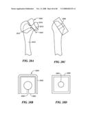 Patient Selectable Joint Arthroplasty Devices and Surgical Tools diagram and image